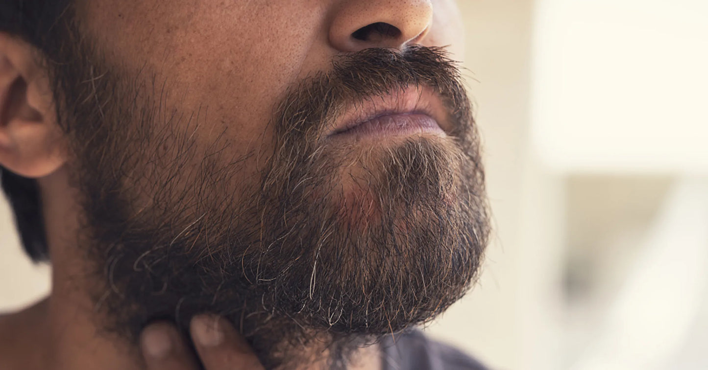 Dry Skin Under Beard: Solve It Like A Pro!